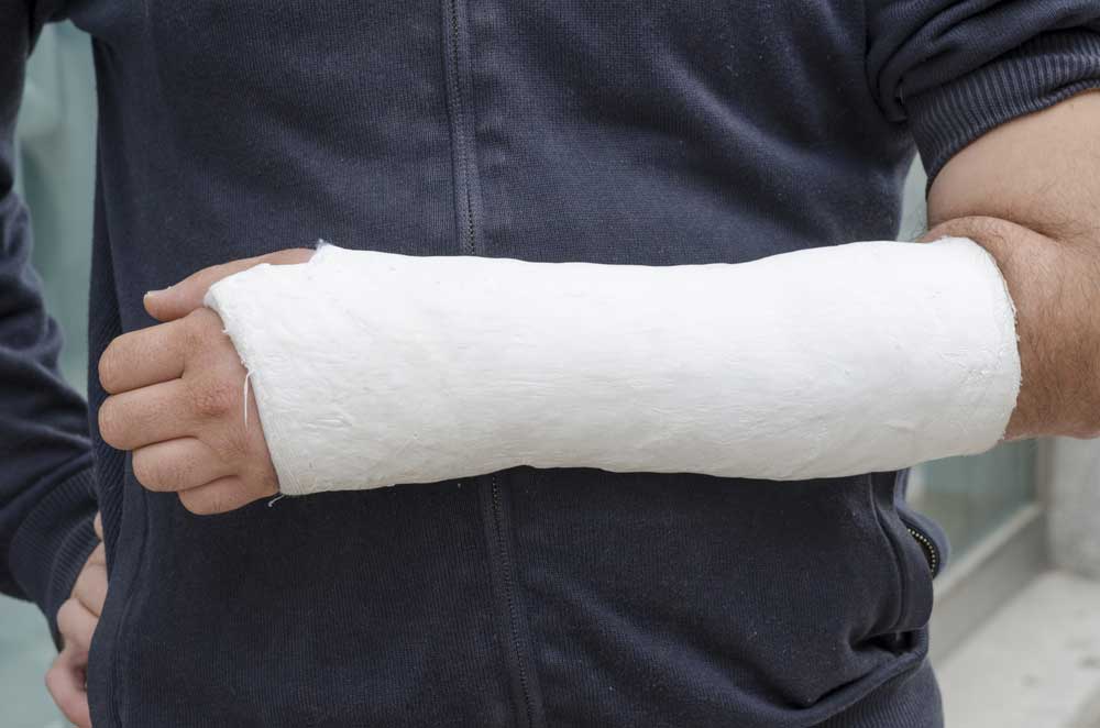 picture of Plaster cast